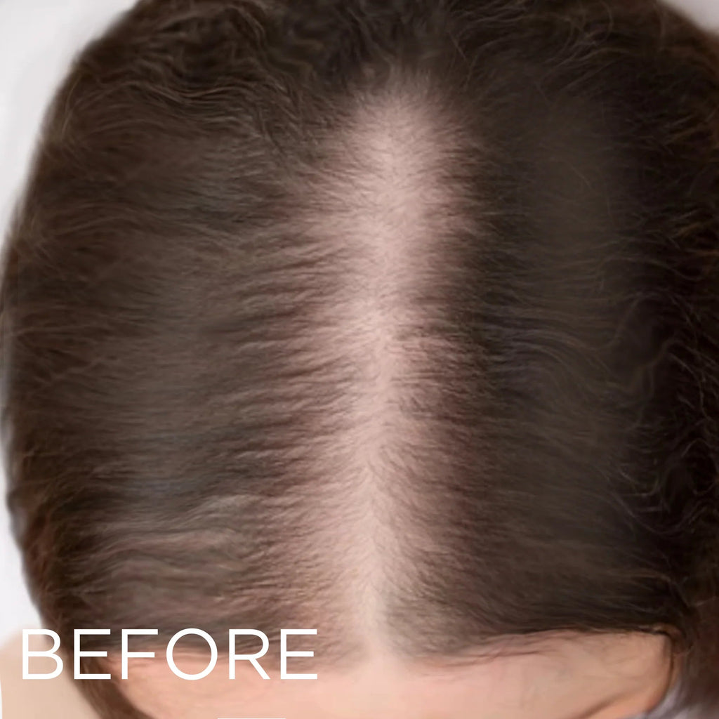 LED Hair Growth Brush – Stop Hair Loss & Regrow Hair Naturally