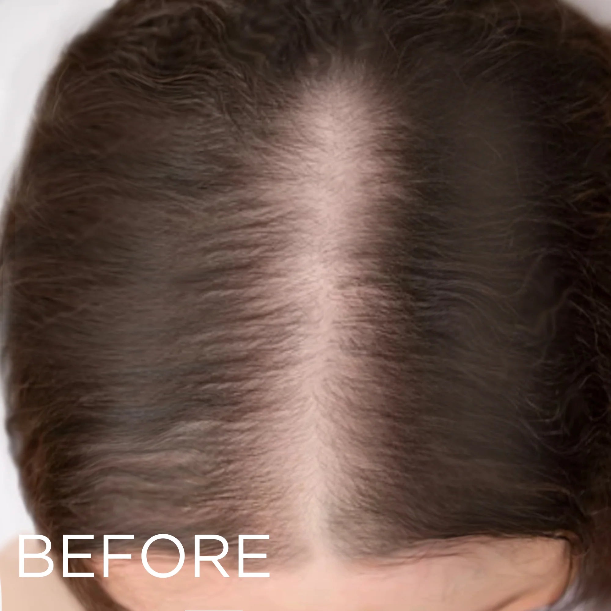 LED Hair Growth Brush – Stop Hair Loss & Regrow Hair Naturally